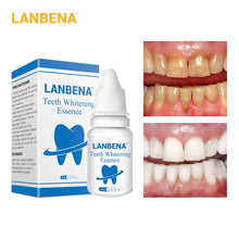 Charger l&#39;image dans la galerie, LANBENA – Poudre d&#39;essence de Blanchiment des Dents,
